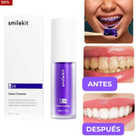 Blanquea y perfecciona tu Dentadura
