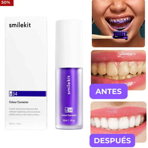 Blanquea y perfecciona tu Dentadura
